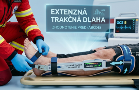 Správna aplikácia trakčnej dlahy pri zlomenine stehennej kosti v prednemocničnej starostlivosti